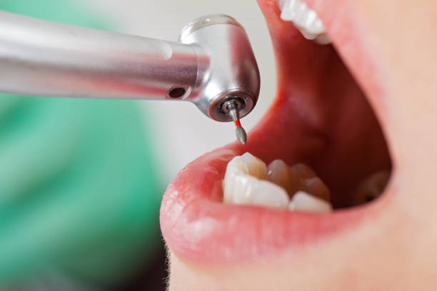 Best Weekend Emergency Dentist in Auburndale, FL